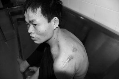 男子被囚清远黑作坊11年 自称曾遭铁棍撬牙